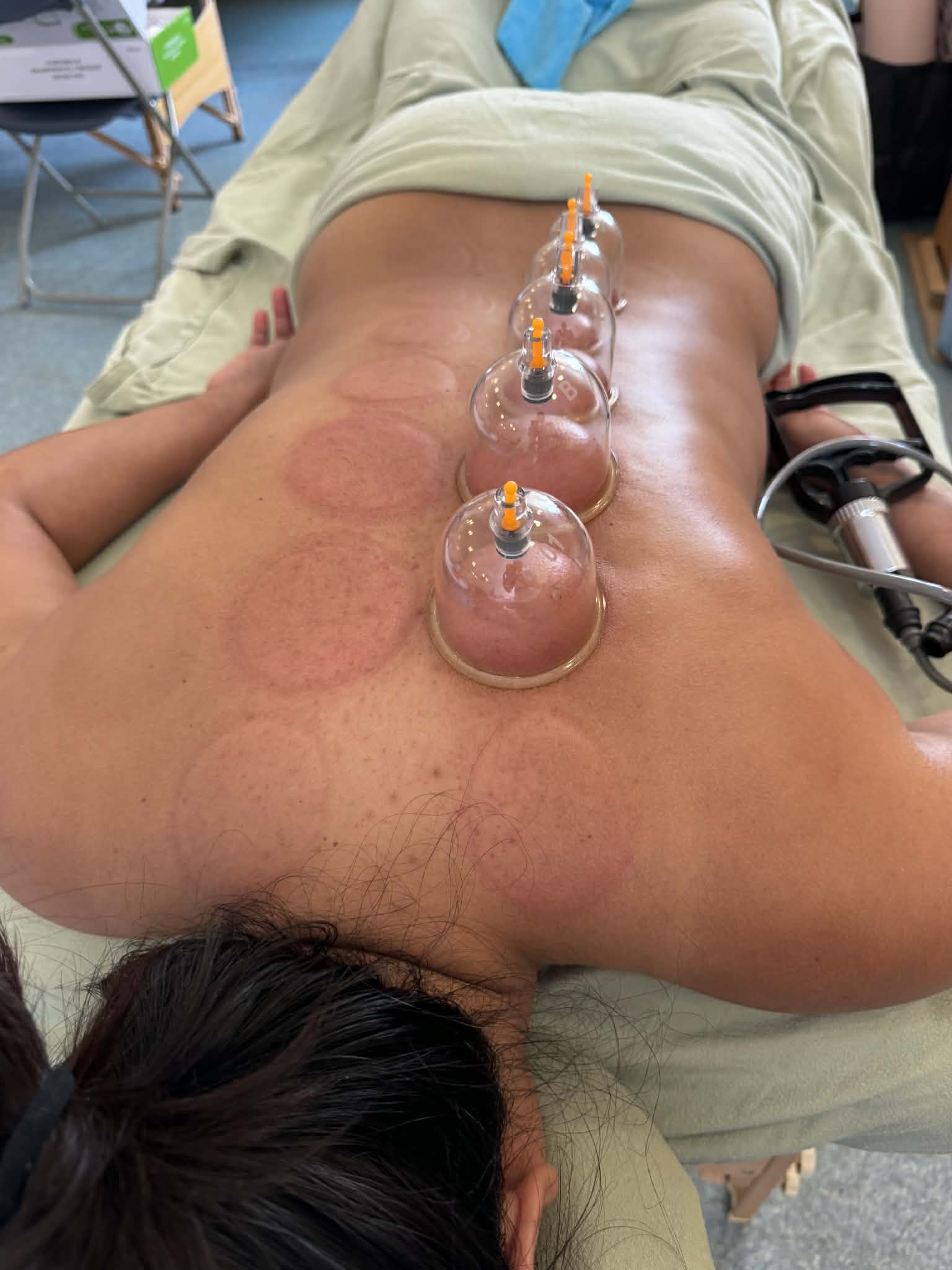 8. Dynamic Cupping massage